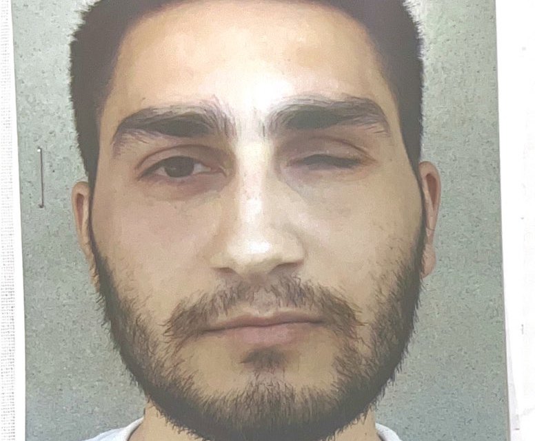 GÖZÜMÜ KOR EDƏNƏ QARŞI MÜSTƏNTİQ DÜZGÜN İSTİNTAQ APARMIR- ZƏRƏRÇƏKMİŞDƏN MÜRACİƏT