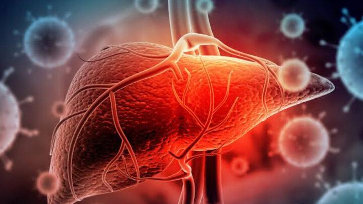 ÜST: Dünyada viral hepatitdən hər gün təqribən 3,5 min nəfər ölür